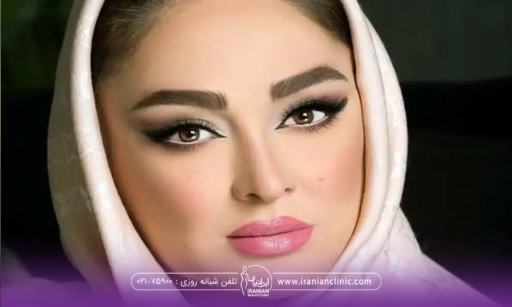 کاشت ابرو الهام حمیدی