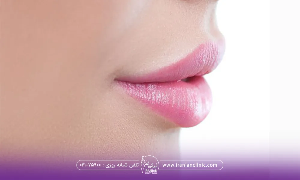 عکس از لبهای دختری که لب های حجیمی دارد و رژ لب صورتی رنگ زده است