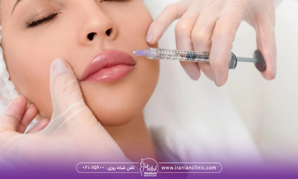 تزریق ژل لب یک خانم در دوره بارداری