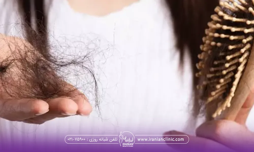 فردی که موهایش را شانه کرده و هم در شانه و هم در دستش مو است 