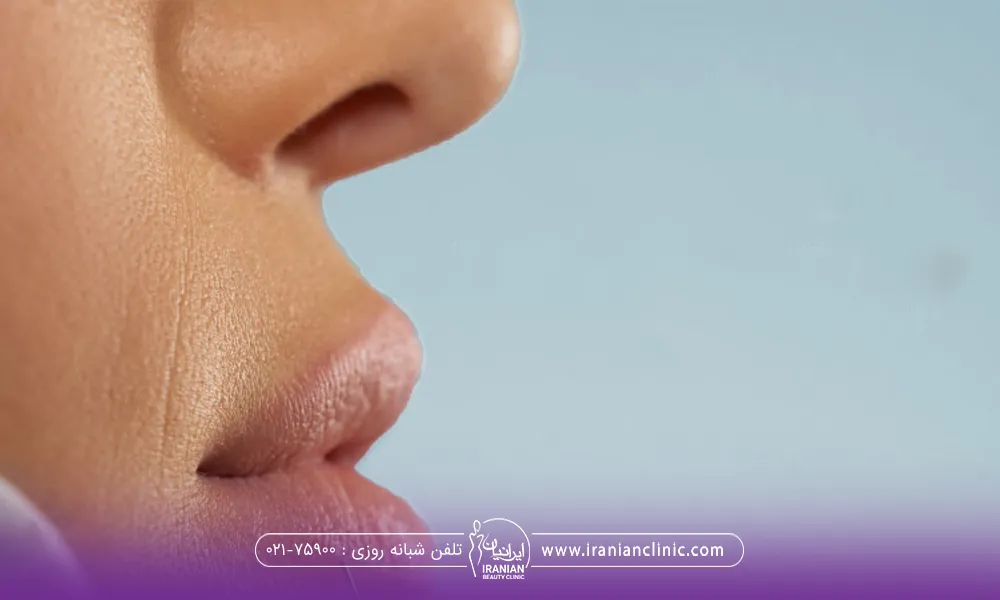 عکس نزدیک از لبهای یک دختر که عکس به صورت نیم رخ از صورت او گرفته شده است