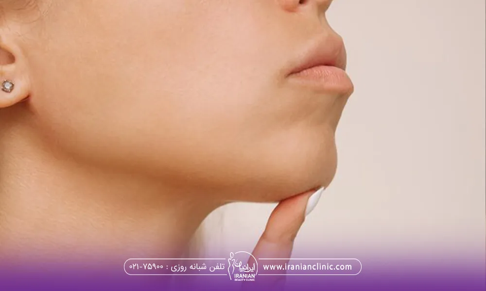 فردی که انگشتش را زیر چانه اش گرفته است - تزریق چربی به چانه