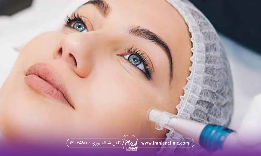 خانمی که دراز کشیده و میکرونیدلینگ روی گونه او قرار گرفته است - مراقبت های بعد از میکرونیدلینگ