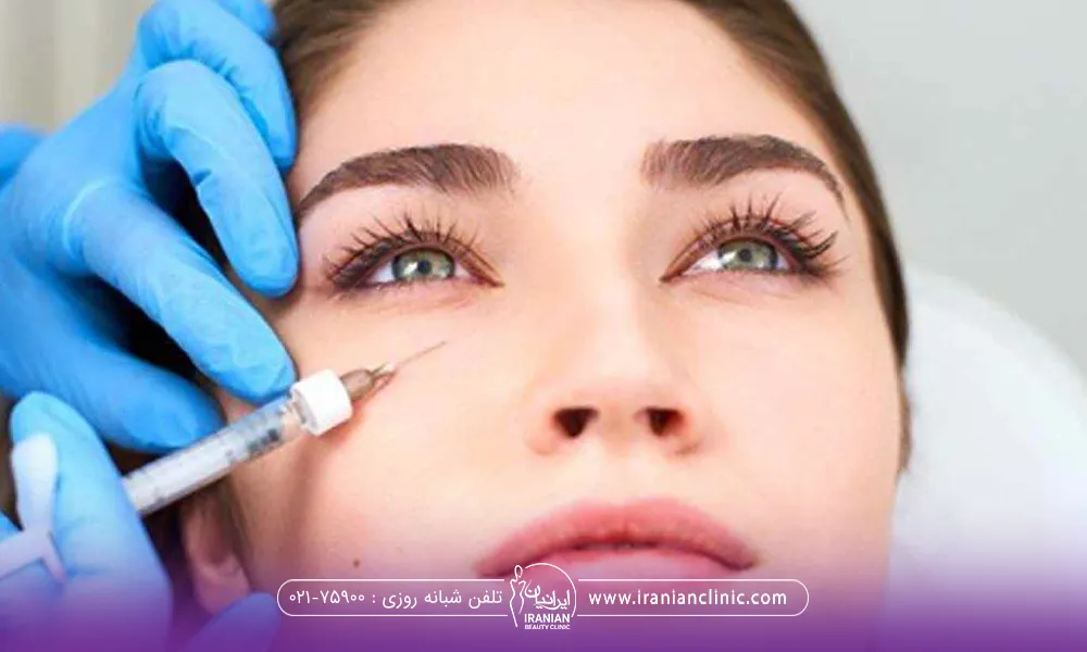 تزریق بوتاکس دور چشم زن
