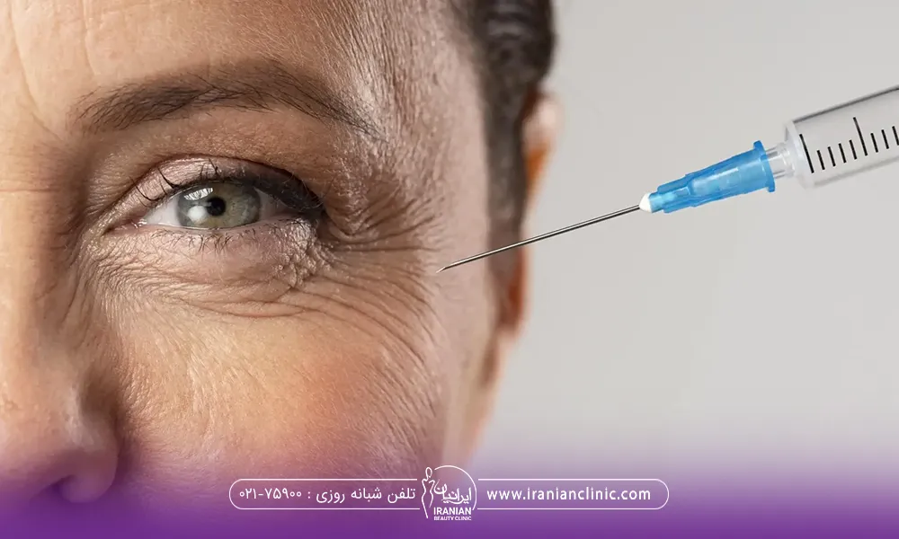 زنی که گوشه چشم های خود خطوط پاکلاغی دارد و سرنگ بوتاکس کنار چشم او نگه داشته شده است