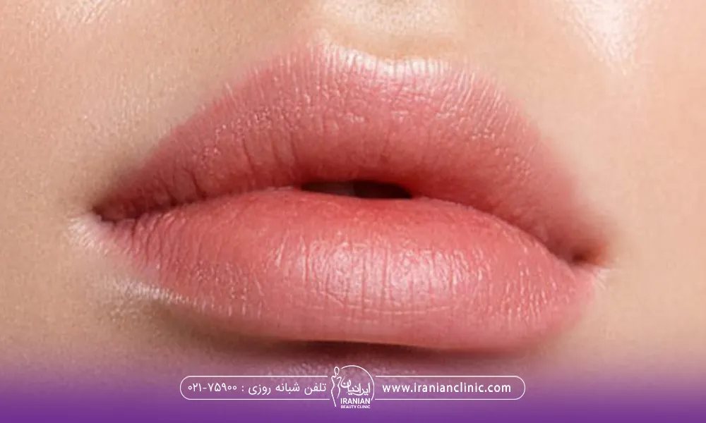لبهای دختر که بی رنگ و روشن است