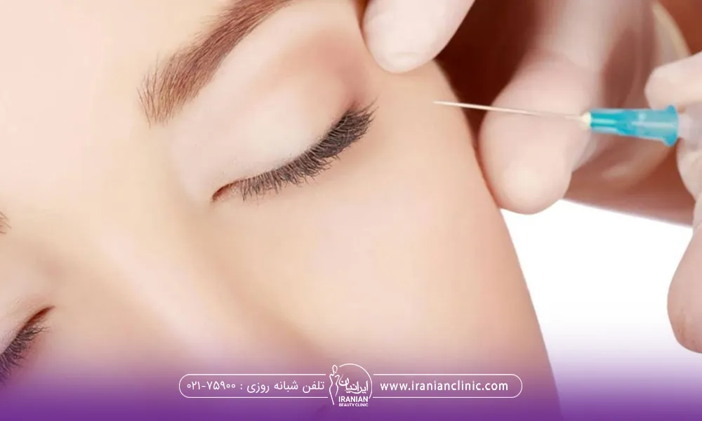 فردی که چشم هایش را بسته است و دستان دکتر که در حال تزریق بوتاکس زیر چشم او است و دست دیگر روی صورت فرد است