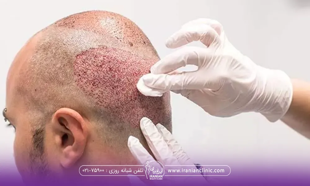 فردی که نشسته است و دستان دکتری که در حال تمیز کردن زخم های پشت سر او است