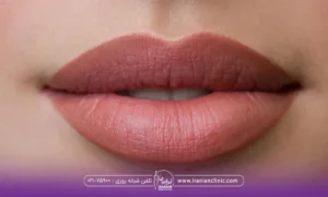 لبهای بالا و پایین دختر که رنگ تیره دارد - شیدینگ لب