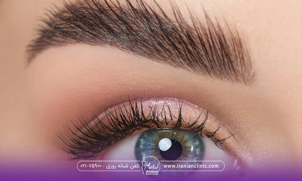 چشم و ابروی دختر که ابروهای او به سمت بالا رفته است