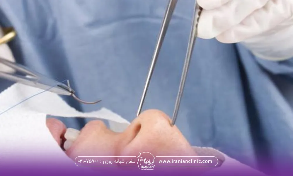 فردی که خوابیده و دکتر درحال بخیه زدن بینی است