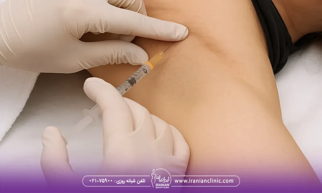 بوتاکس رفع تعریق