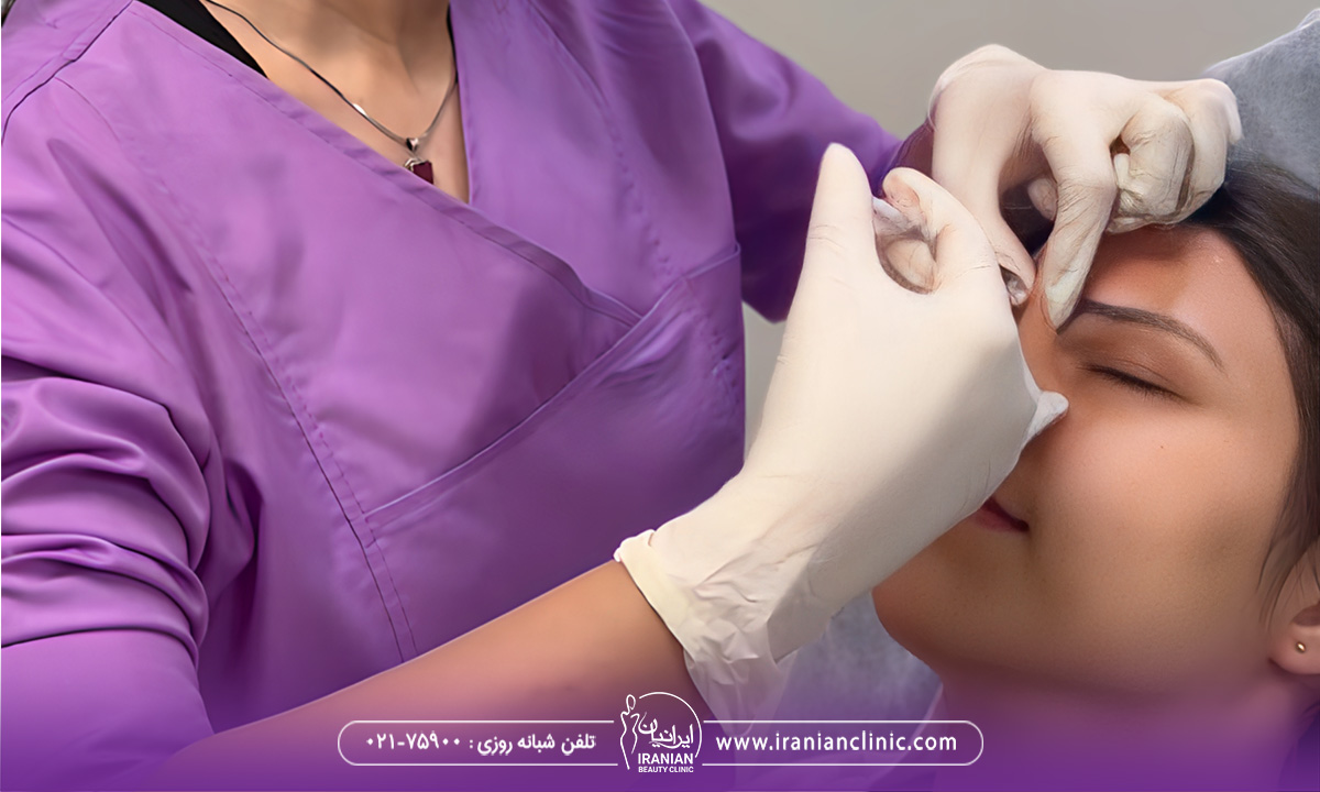 علت سوزش چشم بعد از بوتاکس