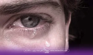 چشم دختری که اشک آلود است و قطره اشک از چشمش سرا زیر شده است - تاثیر گریه بر پوست