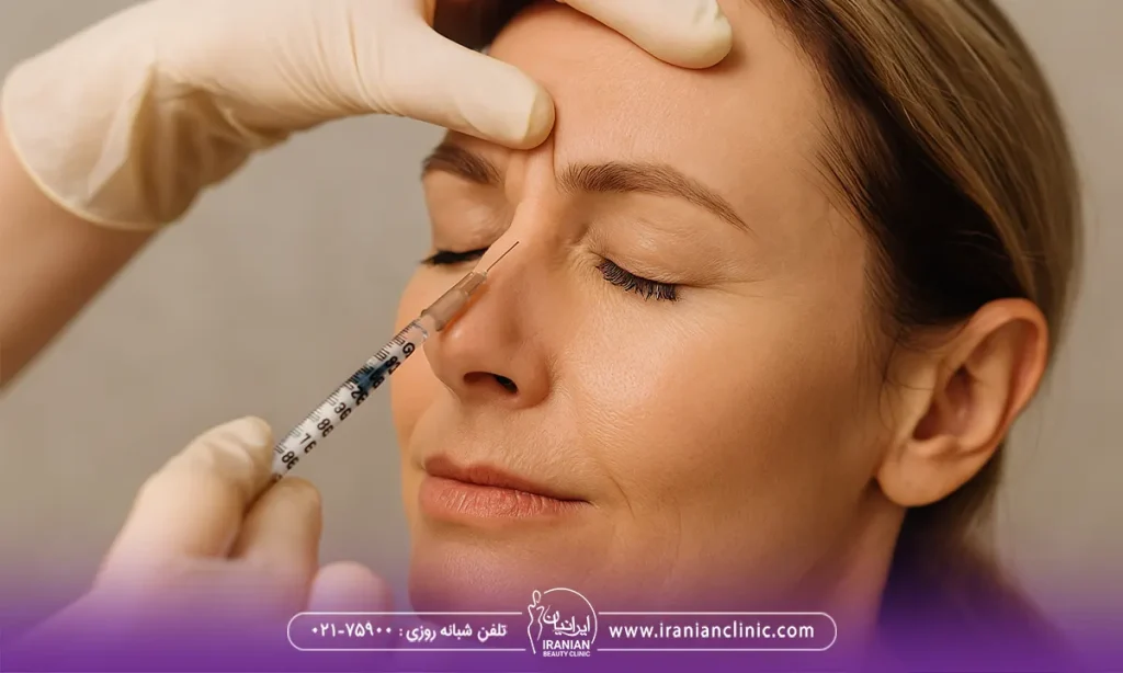 بوتاکس خطوط خرگوشی بینی