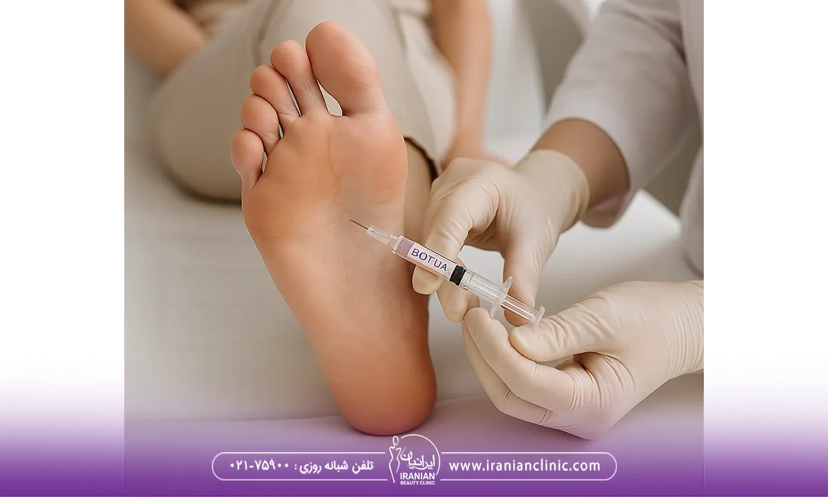 عوارض تزریق بوتاکس کف پا