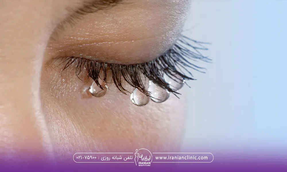 چشم بسته یک دختر که از مژه های او قطرات اشک آویزان است
