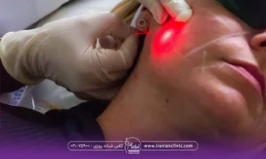 فردی که خوابیده برای انجام اندولیفت صورت