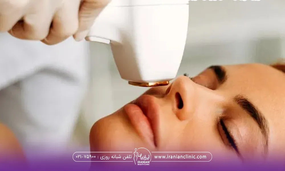 خانومی که خوابیده است و چشم هایش بسته است و دست اپراتور که دستگاه لیزر دستش است و در حال لیزر کردن صورت فرد است