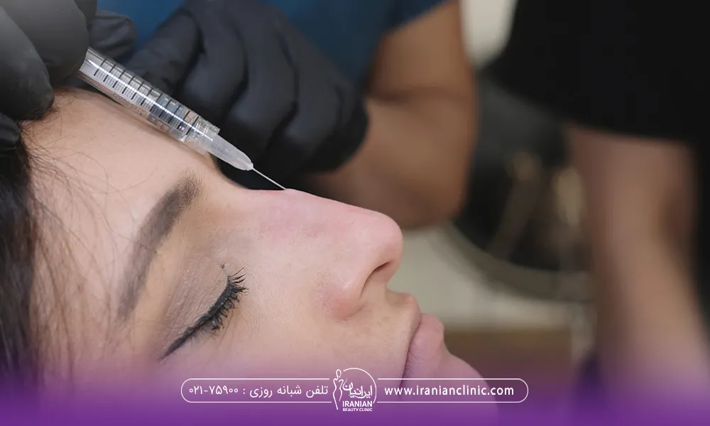 خانمی که چشم هایش بسته است و دست دکتری که سرنگ دستش است و سر سوزنی که در روی بینی خانم فرو رفته است که در حال انجام تزریق فیلر بینی استخوانی است