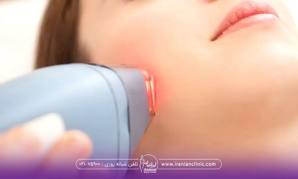 در عکس قسمتی از صورت فرد نشان داده شده که اپراتور در حال لیزر کردن صورت است - لیزر موهای زائد سعادت آباد​