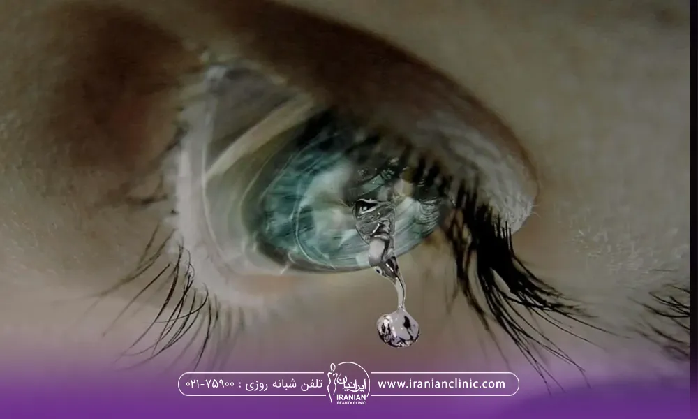 عکس نزدیک از چشم رنگی که از داخل آن اشک می ریزد