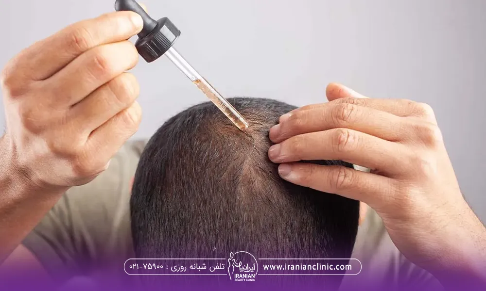 فردی که سر خود را پایین گرفته و سر انگشتان یک دستش رو موهایش اس و دیگر دست با قطره چکان به دست در حال چکاندن قطره روی سر خود است