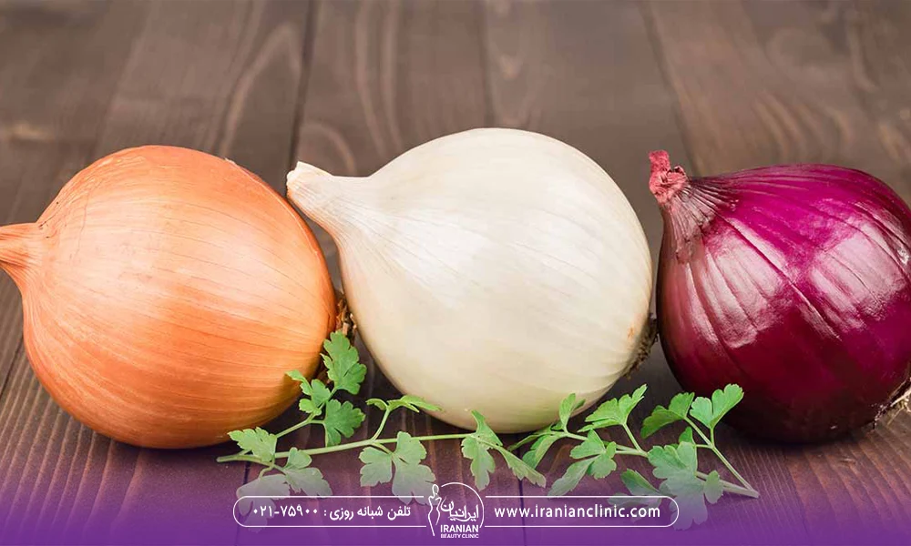 یک پیاز سفید و یک پیاز بنفش و یک پیاز نارنجی - پیاز بعد از کاشت مو