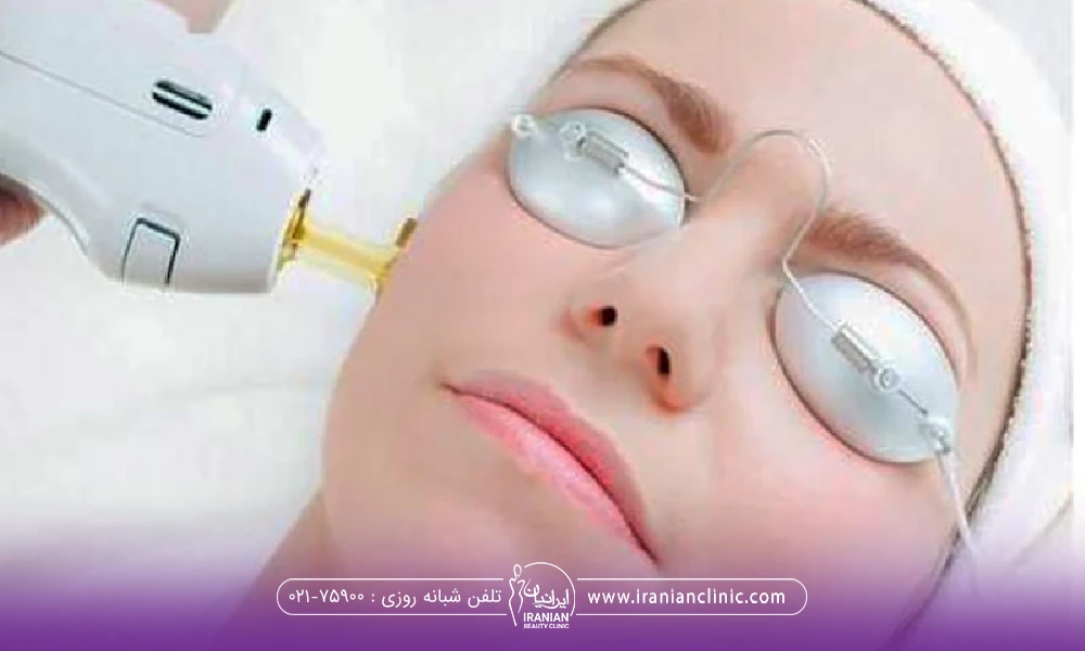 فردی که خوابیده و کلاه و عینک مخصوص زده است و دست اپراتور در حال لیزر کردن صورت فرد است - لیزر موهای زائد در میرداماد
