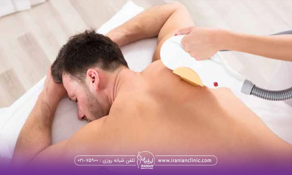 مردی که روی شکمش خوابیده است و دست اپراتور در حال لیزر کردن موهای زائد کمر است