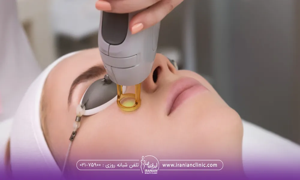 خانمی که خوابیده و عینک مخصوص لیزر به چشم دارد و دست اپراتور در حال انجام لیزر صورت فرد است