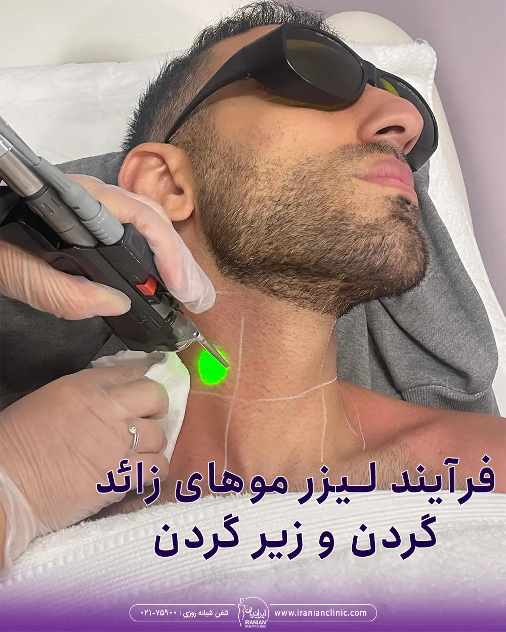 نحوه لیزر موهای زائد گردن و زیر گردن مرد جوان