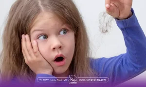 دختری که مقداری از موهایش را در دست گرفته و دست دیگر روی صورتش است و با تعجب به موی ریخته خود نگاه میکند - دلیل ریزش مو در کودکان