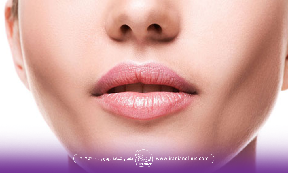 عکس از صورت دختری که صورت لاغر و زاویه فک مشخصی دارد