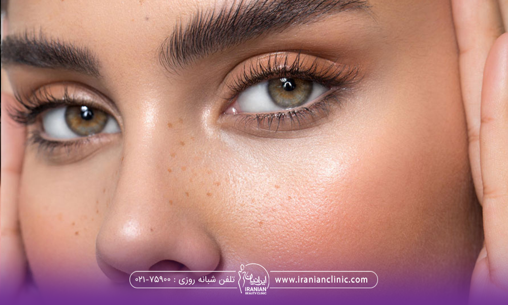 دختری که با دست هایش شقیقه هایش را گرفته و کشیده است