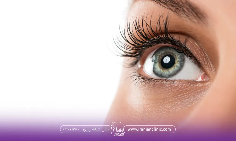 دختری که با چشم های رنگی به سمت بالا نگاه می کند - بلفاروپلاستی پلک پایین