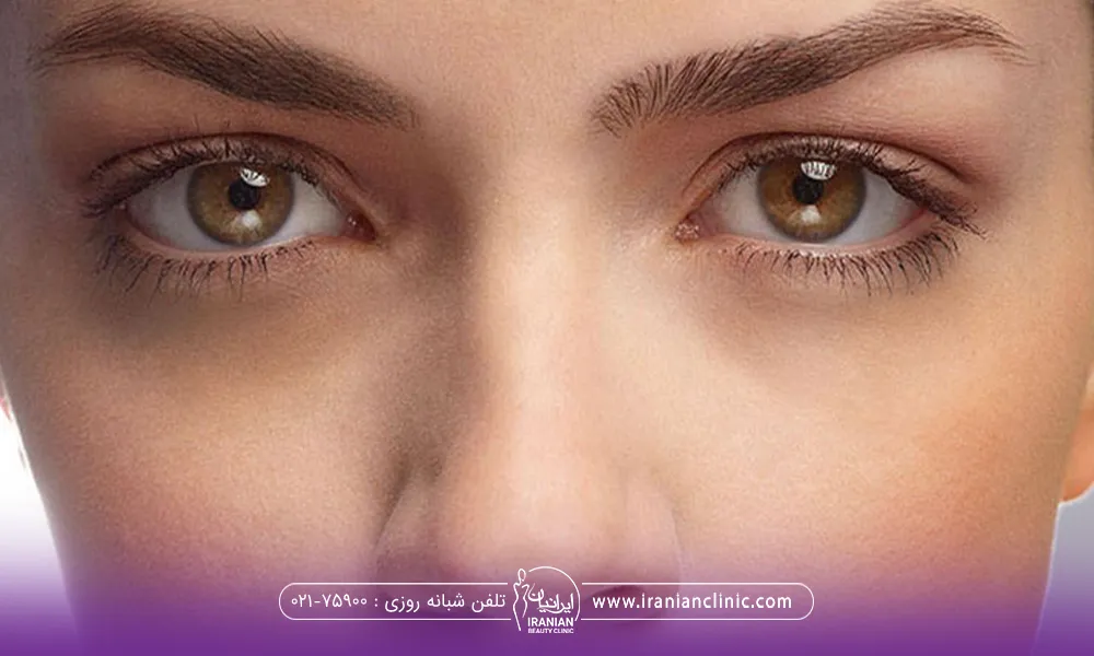 عکس نزدیک از صورت دختر با چشمان قهوه ای