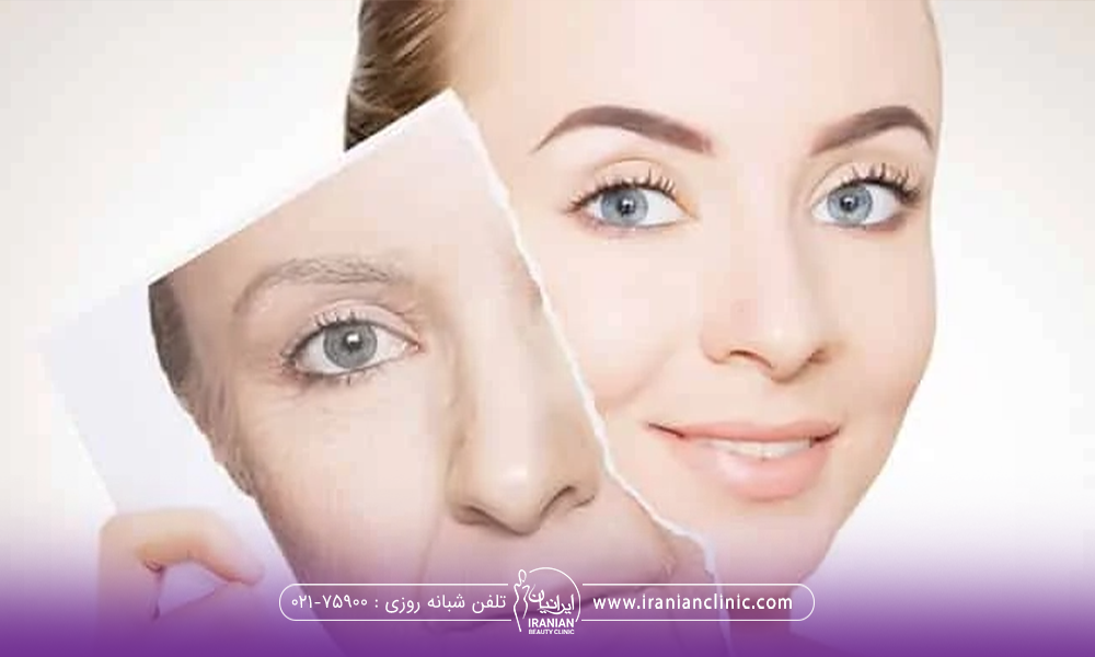 خانم خوشحالی که چهره قدیم خود را مثل برگ کاغذ کنده و کنار صورت خود نگه داشته است