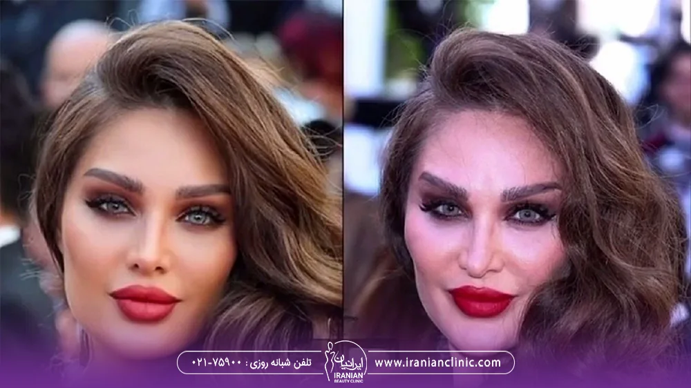 عکس ادیت شده طلا گلزار در سمت چپ و عکس واقعی او در سمت راست
