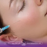 عکس از قسمت صورت فردی که خوابیده و دست دکتری که در حال تزریق فیلر به گونه میباشد - مراقبت های بعد از تزریق ژل گونه