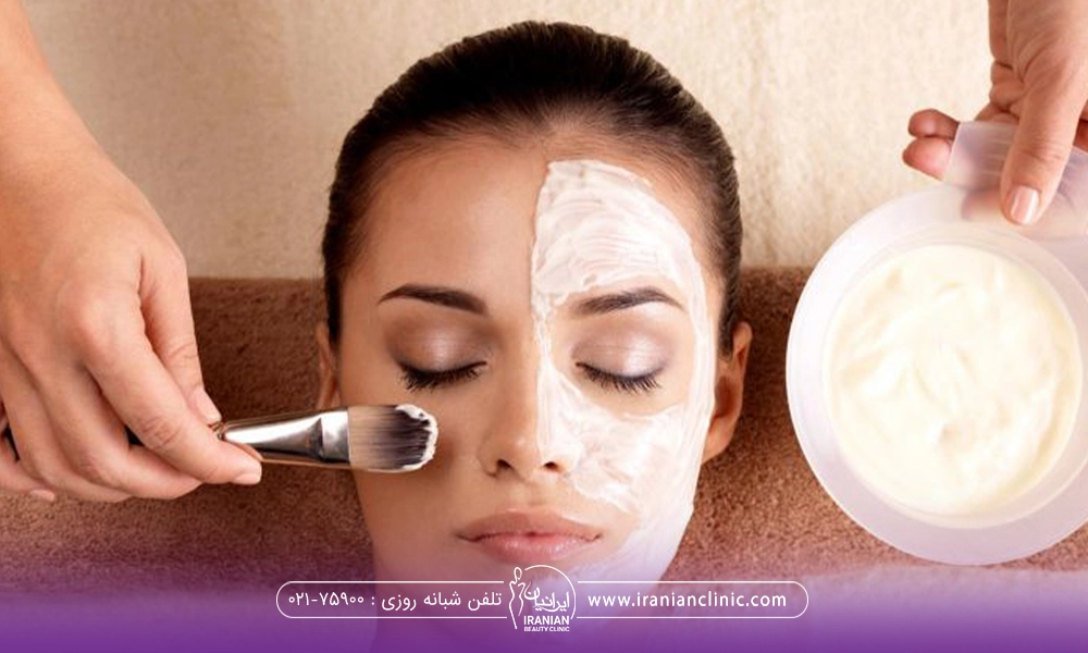دست فردی که روی صورت خانم در حال گذاشتن ماسک جوش شیرین و سرکه است