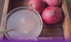 در تصویر یک کاسه آب پیاز و کنار آن چند عدد پیاز قرمز وجود دارد - خواص آب پیاز سفید برای پوست