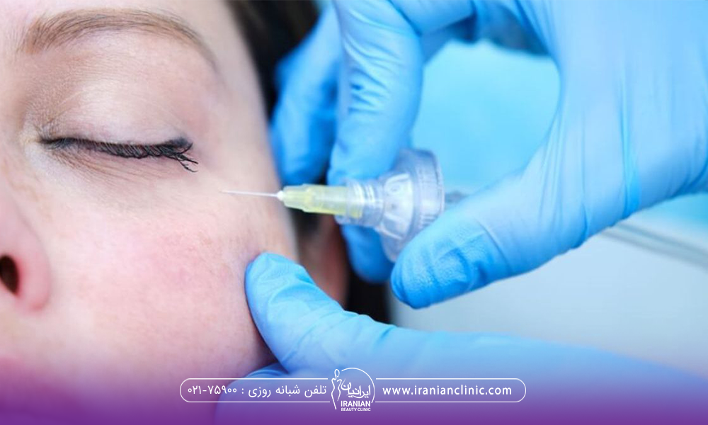 چشم خانمی که بسته است و دستان دکتر در حال انجام کربوکسی تراپی زیر چشم است - مراقبت های بعد از کربوکسی تراپی