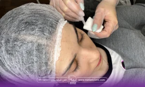 عکس از بالا سر خانم جوانی که نشسته و کلاه مخصوص به سر دارد و دستان دکتری که در حال تزریق است - کربوکسی تراپی در سعادت آباد​