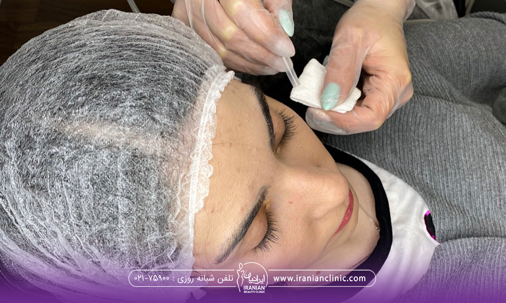 عکس از بالا سر خانم جوانی که نشسته و کلاه مخصوص به سر دارد و دستان دکتری که در حال تزریق است - کربوکسی تراپی در سعادت آباد