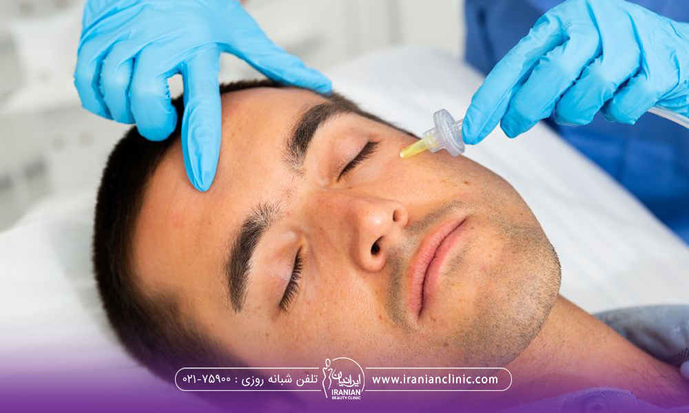 مرد جوانی که چشمانش را بسته است و پزشک زیر چشم او را کربوکسی تراپی می کند