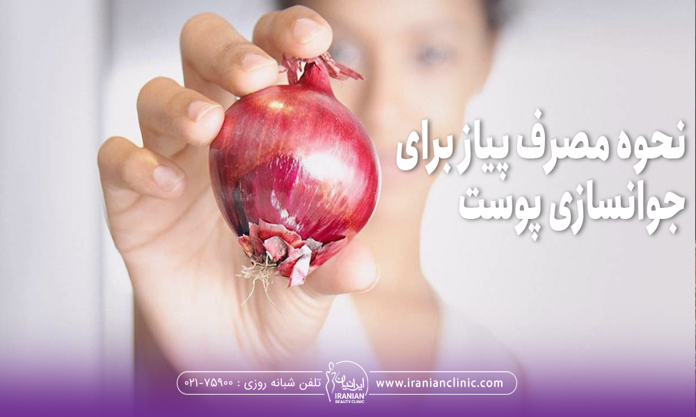 فردی که دستش را جلو آورده و یک پیاز دستش است