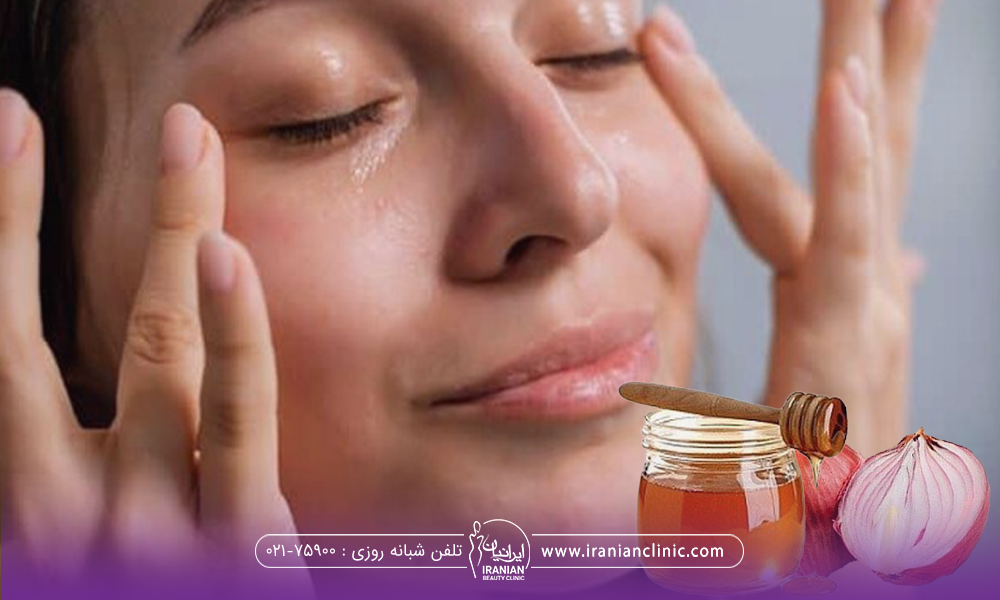 عکس از صورت دختر که در گوشه عکس یک کاسه عسل و یک پیاز نصف شده وجود دارد