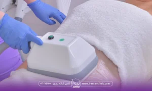 فردی که خوابیده و دست اپراتوری که در حال نگه داشتن دستگاه کوتیشن روی شکم خانم است - مراقبت های بعد از کویتیشن