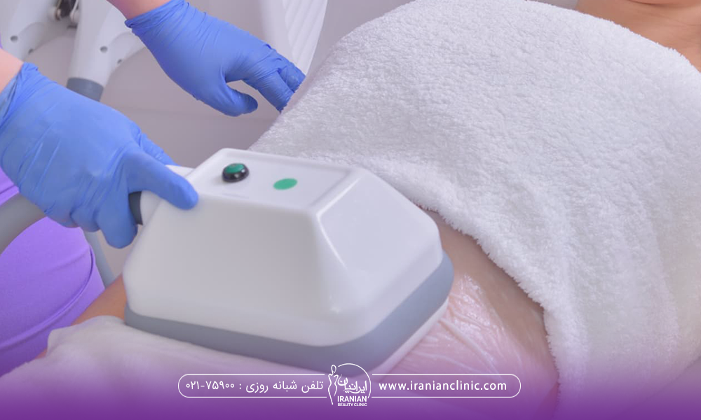 فردی که خوابیده و دست اپراتوری که در حال نگه داشتن دستگاه کوتیشن روی شکم خانم است - مراقبت های بعد از کویتیشن